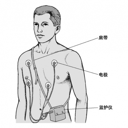 google-wearable-ecg-patent-2.jpg google-wearable-ecg-patent-2.jpg